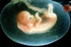 آخرین ویرایش غربالگری سلامت جنین 96